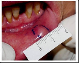 labial-fig2