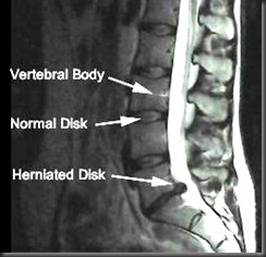 spineMRI